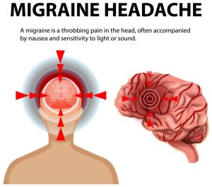 Migraine & Headache | Best Neurology specialist in Hyderabad | Dr. Soumya Reddy | Canes Cardio & Neuro Clinic Kondapur