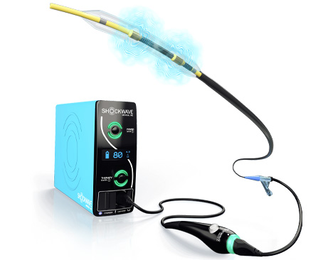 Rotablation / Atherectomy / IVL | Best Cardiology specialist in Hyderabad | Dr. Kiran Kumar Lakki Reddy | Canes Cardio & Neuro Clinic Kondapur