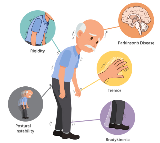 Parkinson’s Disease | Best Neurology specialist in Hyderabad | Dr. Soumya Reddy | Canes Cardio & Neuro Clinic Kondapur