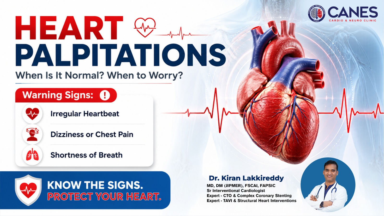 Heart Palpitations - Dr kiran Lakkireddy Cardiologist | CANES Clinic