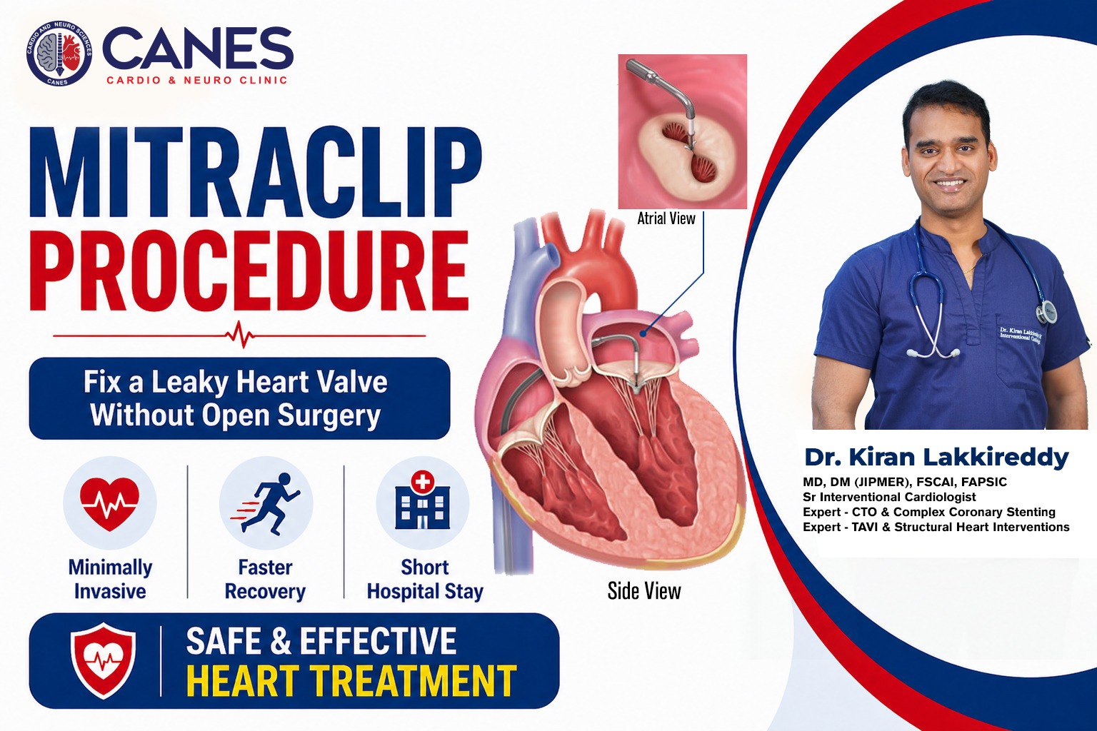 MitraClip Procedure | Dr Kiran Lakkireddy | Best Cardiologist In Hyderabad