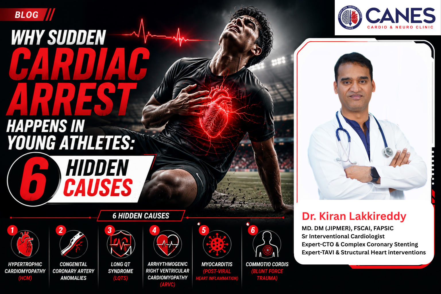 Sudden Cardiac Arrest Happens in Young Athletes - Dr Kiran Lakkireddy Cardiologist - CANES Clinic