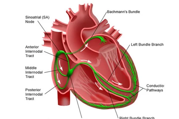 Electrophysiology (EP Study & RF Ablation) in Kondapur - Dr Kiran Lakkireddy Cardiologist - CANES Clinic