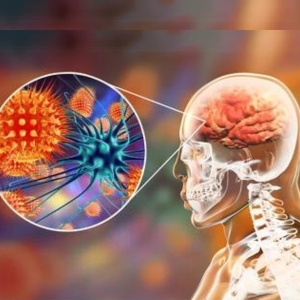 CNS Infections Treatment in Kondapur - Dr Soumya Neurologist - CANES Clinic
