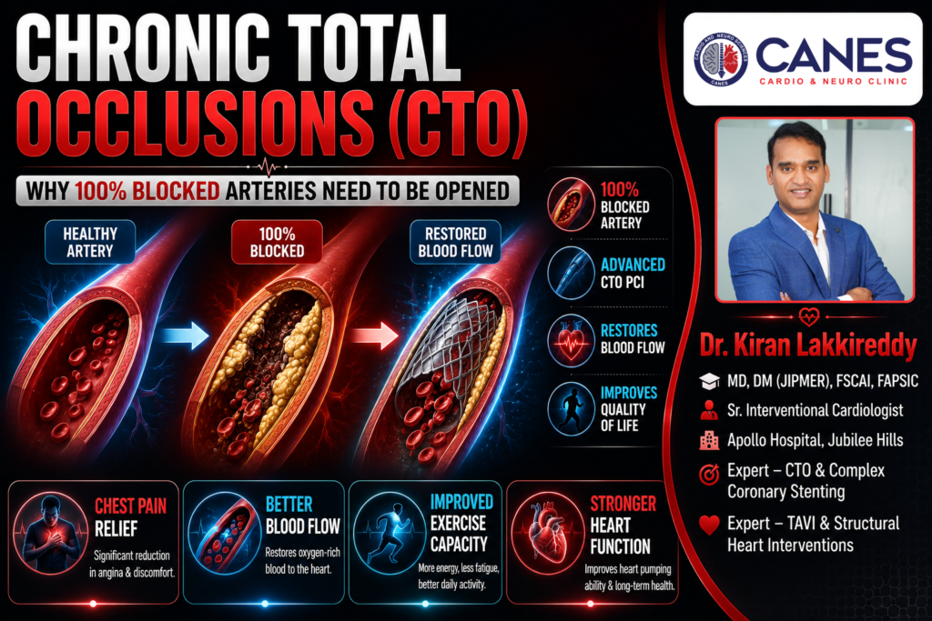 Chronic total occlusion