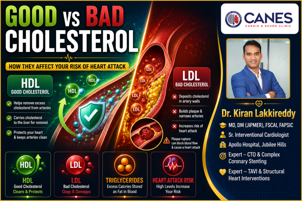 Good and bad cholesterol - Dr kiran Lakkireddy Cardiologist Hyderabad, Kondapur