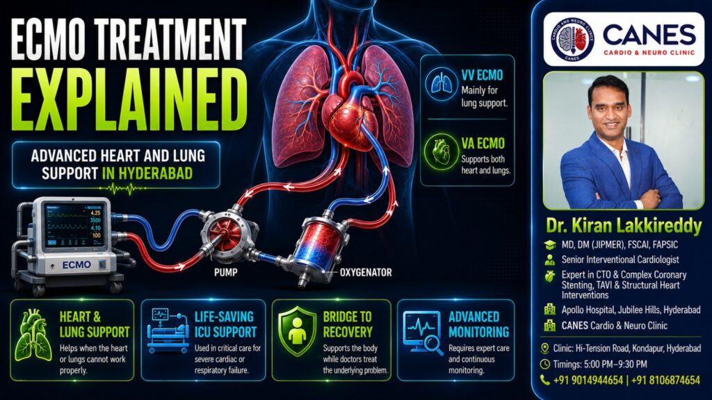 ECMO life support