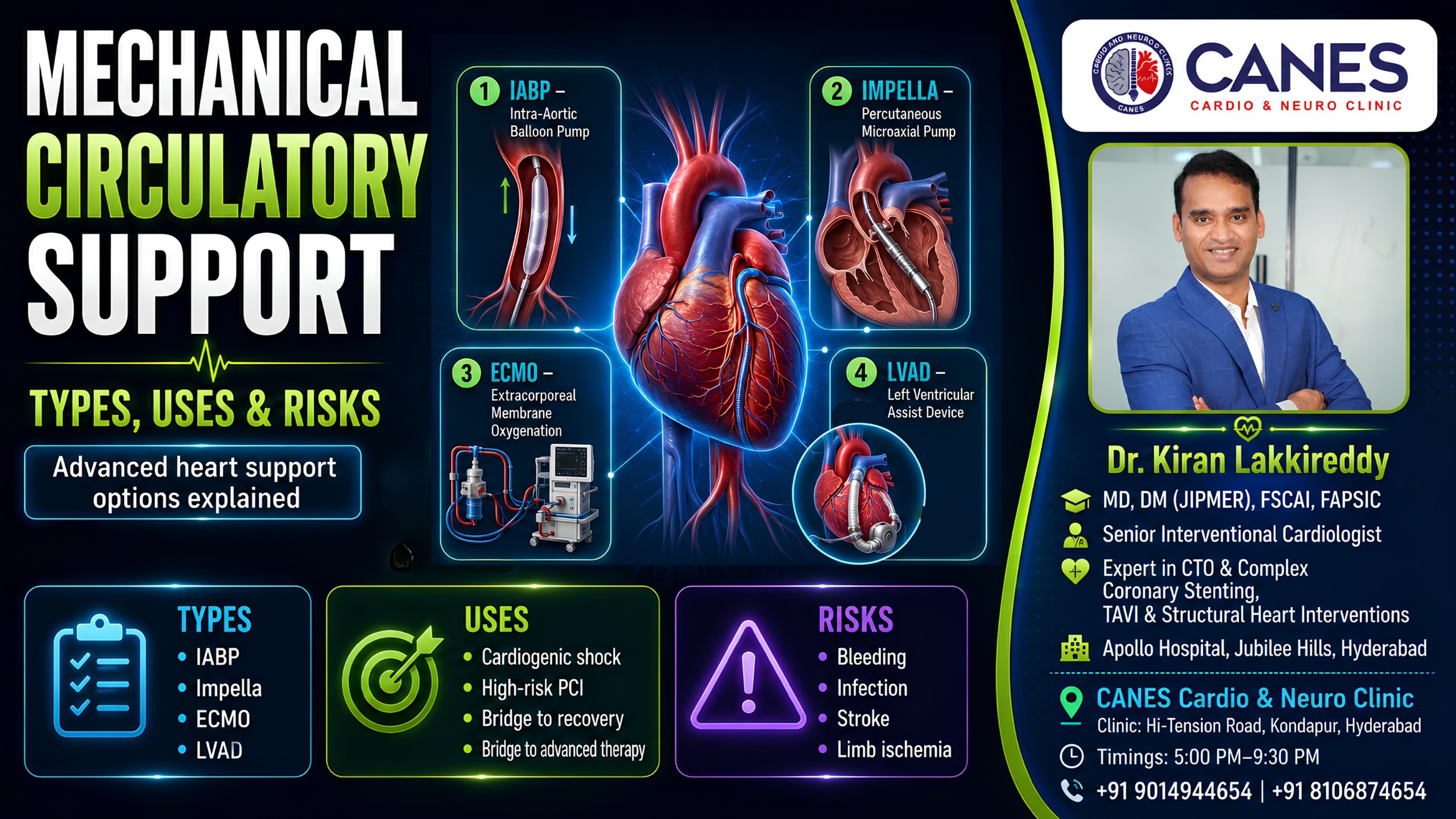 Mechanical circulatory support